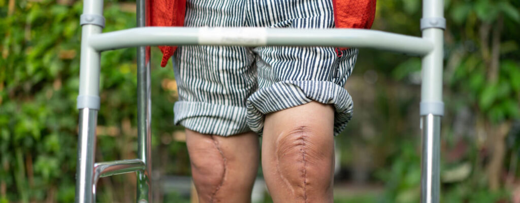 Knee Pain
